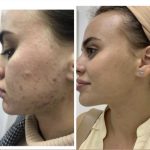 KakaoTalk_20241010_112936386_01