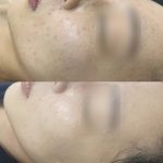 KakaoTalk_20241010_112936386_08